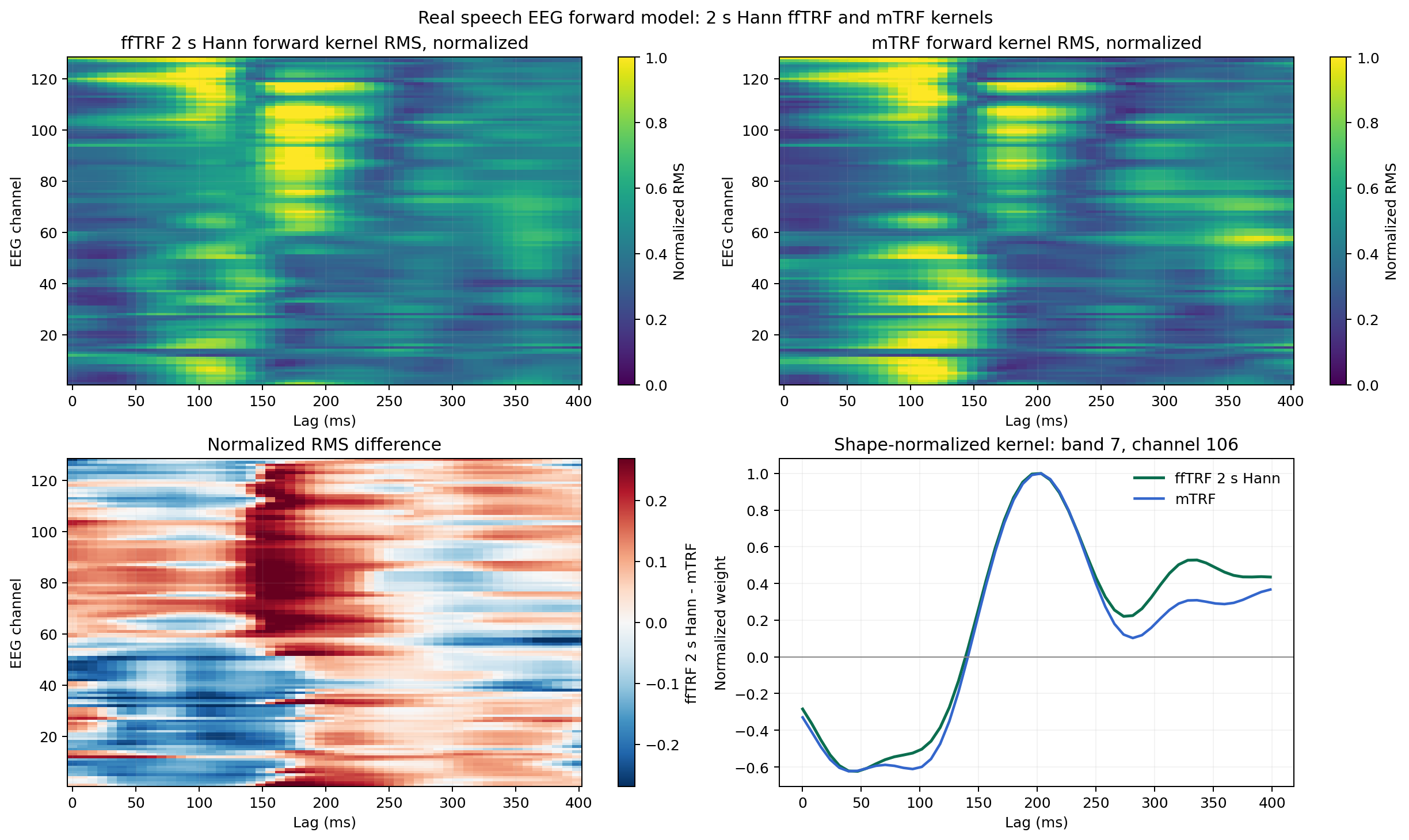 Real EEG forward kernel comparison
